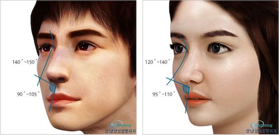 Nose Job in Korea